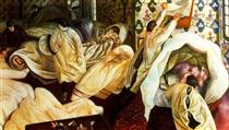 Patient Suffering From Frostbite - Stanley Spencer